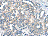 AURKA Polyclonal Antibody