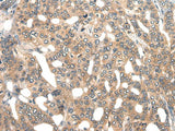 GPR55 Polyclonal Antibody