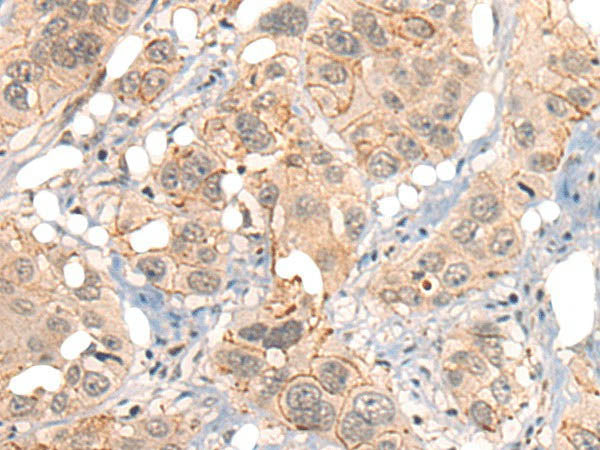 GPR55 Polyclonal Antibody
