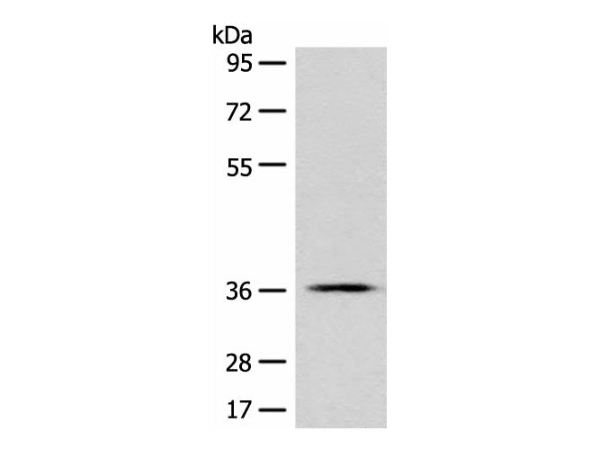 GPR55 Polyclonal Antibody