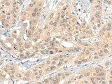 HIPK2 Polyclonal Antibody