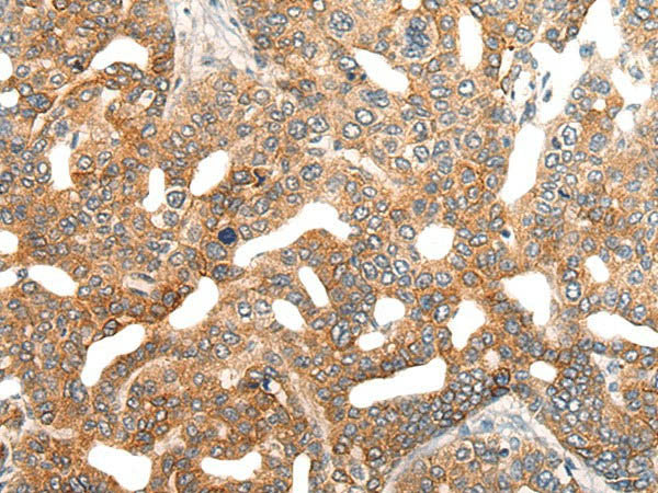HIPK2 Polyclonal Antibody