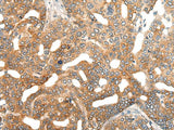 HIPK2 Polyclonal Antibody