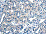 MARK2 Polyclonal Antibody