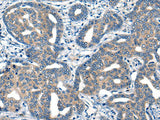 MIIP Polyclonal Antibody