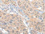 MIIP Polyclonal Antibody
