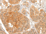NOG Polyclonal Antibody