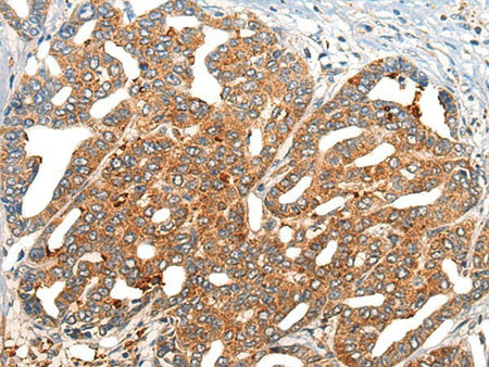 NOG Polyclonal Antibody