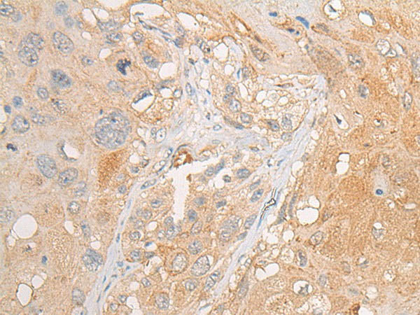 PCDHGB5 Polyclonal Antibody