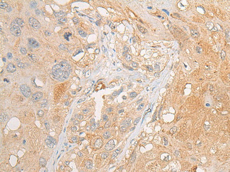 PCDHGB5 Polyclonal Antibody