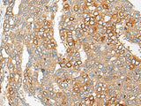PCDHGB5 Polyclonal Antibody