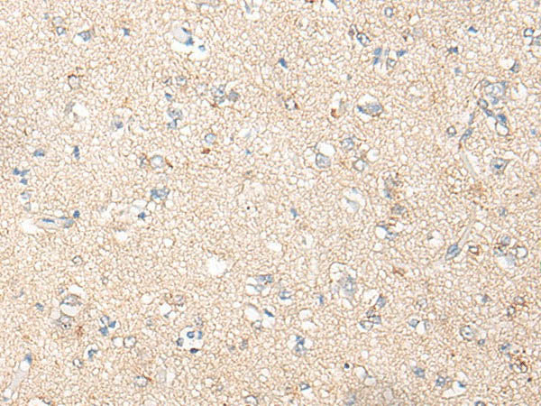 PNPO Polyclonal Antibody