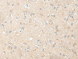 PNPO Polyclonal Antibody