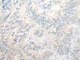 PNPO Polyclonal Antibody