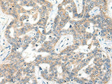 SNX6 Polyclonal Antibody