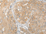 SNX6 Polyclonal Antibody