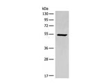 ACD Polyclonal Antibody