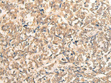 CPS1 Polyclonal Antibody