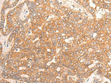 CPS1 Polyclonal Antibody