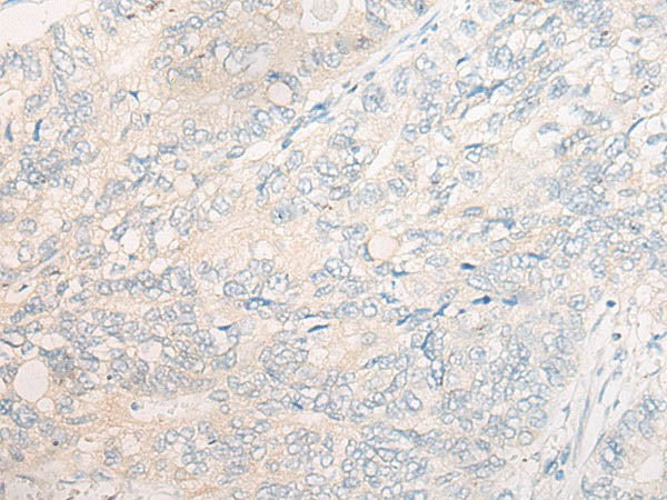 CYB5R3 Polyclonal Antibody