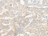 CYB5R3 Polyclonal Antibody