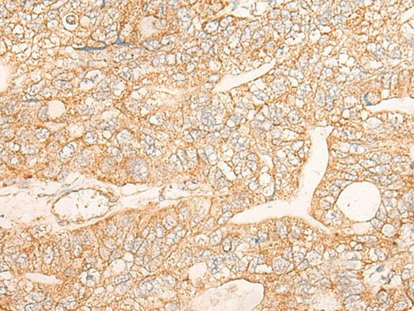 KRT9 Polyclonal Antibody