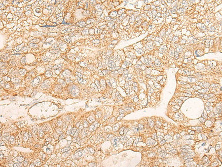 KRT9 Polyclonal Antibody