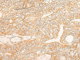 KRT9 Polyclonal Antibody