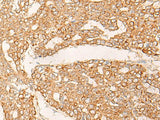 KRT9 Polyclonal Antibody