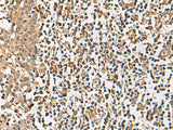 DCAF12 Polyclonal Antibody