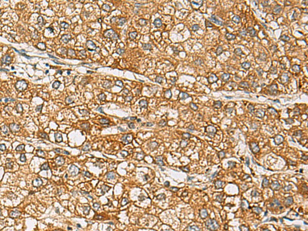 DCAF12 Polyclonal Antibody
