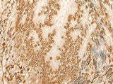 HIST1H2BA Polyclonal Antibody