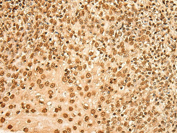 HIST1H2BA Polyclonal Antibody