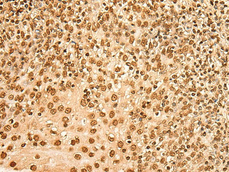 HIST1H2BA Polyclonal Antibody