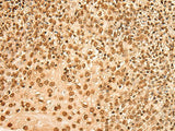HIST1H2BA Polyclonal Antibody