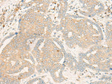 FBXO32 Polyclonal Antibody