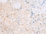 DPCD Polyclonal Antibody