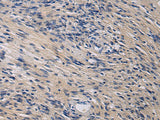 KLF1 Polyclonal Antibody