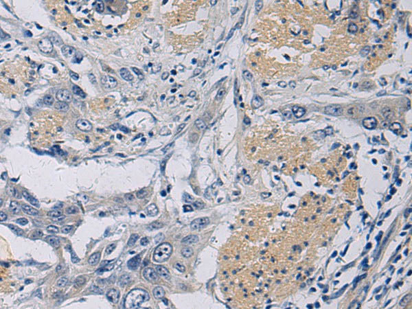 KLF1 Polyclonal Antibody