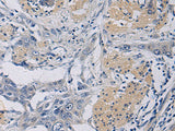 KLF1 Polyclonal Antibody