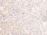 EME2 Polyclonal Antibody