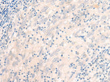 EME2 Polyclonal Antibody