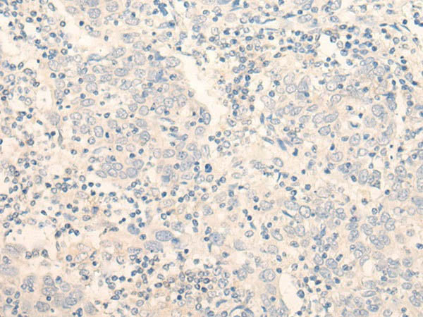 ADGRE3 Polyclonal Antibody