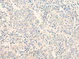 ADGRE3 Polyclonal Antibody