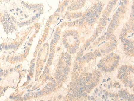 ADGRE3 Polyclonal Antibody