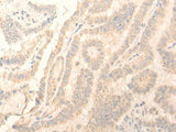 ADGRE3 Polyclonal Antibody
