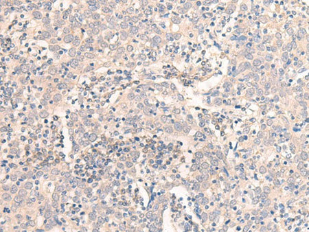 EMX1 Polyclonal Antibody
