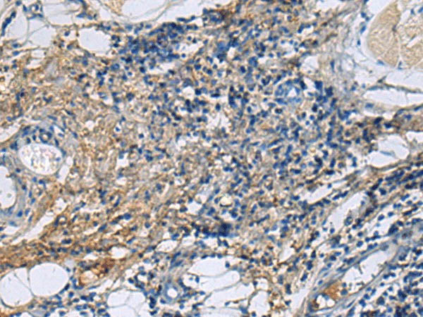 PROC Polyclonal Antibody