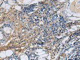 PROC Polyclonal Antibody