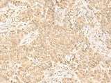 IL32 Polyclonal Antibody